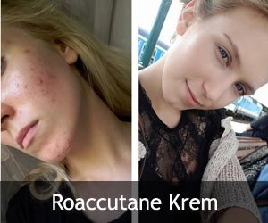 Avene Cicalfate Krem - Kullanıcı Yorumları 6