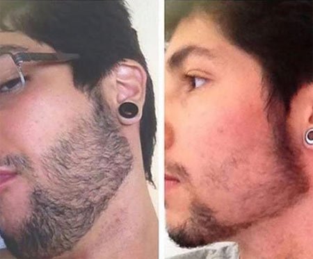 erkeklerde sakal çıkmasını sağlamak 2