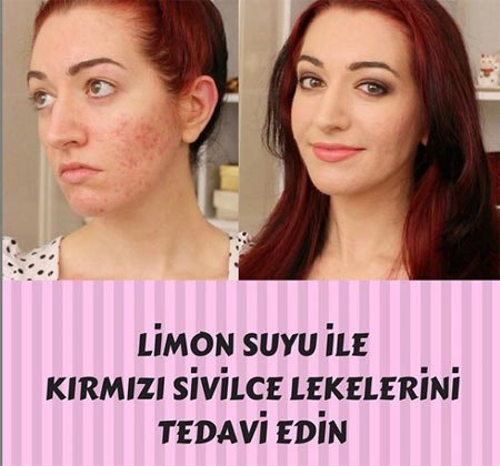 kirmizileke_01