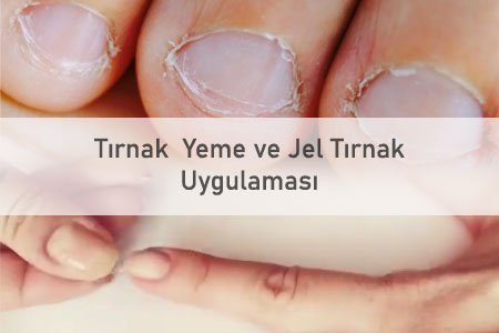 Jej_tirnak_uygulamasi