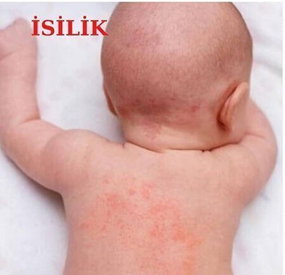 bebekelrde-islik-001-1