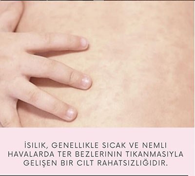 Bebeklerde İsilik 2
