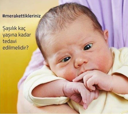 Bebeklerde Şaşılık 2 Bebeklerde Şaşılık