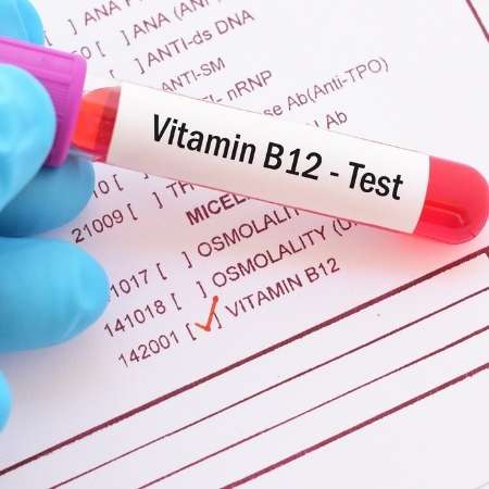 B12 Vitamin