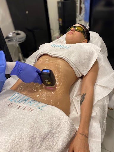 Genital Bölge Hassasiyetinde Buz Lazer Epilasyon Farkını Hissedin 1