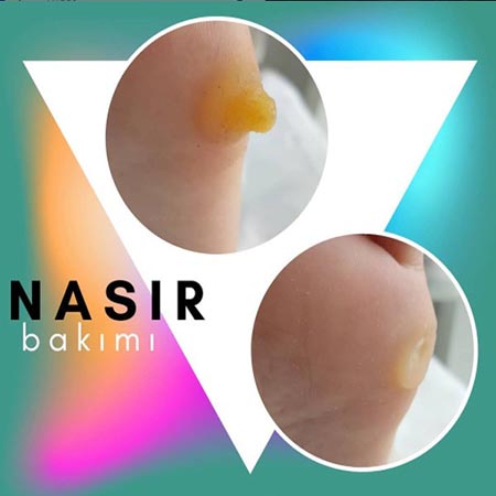 Nasırlar